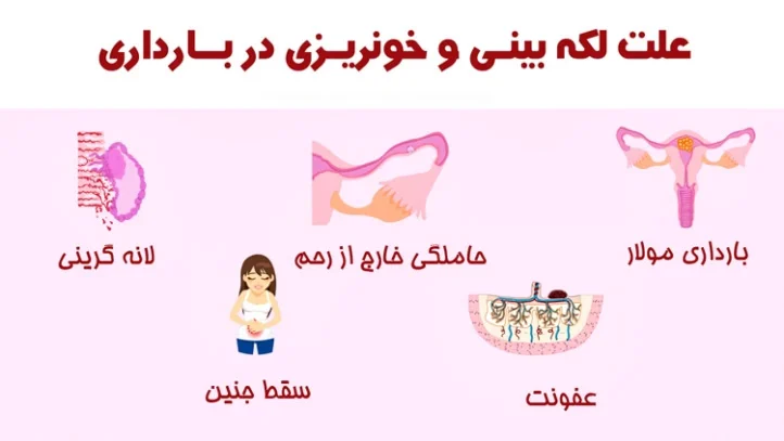 علل لکه بینی در بارداری چیست و چه زمانی خطرناک یا طبیعی است؟