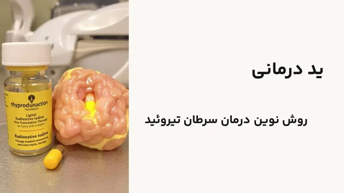 بیماری | سرطان ید درمانی برای سرطان تیروئید چگونه عمل میکند؟