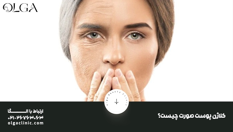 کلاژن و نقش آن در جوانسازی پوست